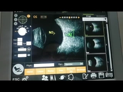 Definição axial super alta ultrassônica da máquina 10MHz do varredor da função do cálculo de IOL