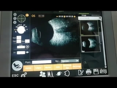 Máquina 10MHz da varredura da varredura B do fã observando o destacamento retina