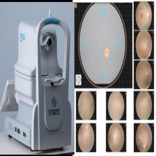 Câmera retiniana portátil não-midriática com foco manual da pupila de 2,8 mm