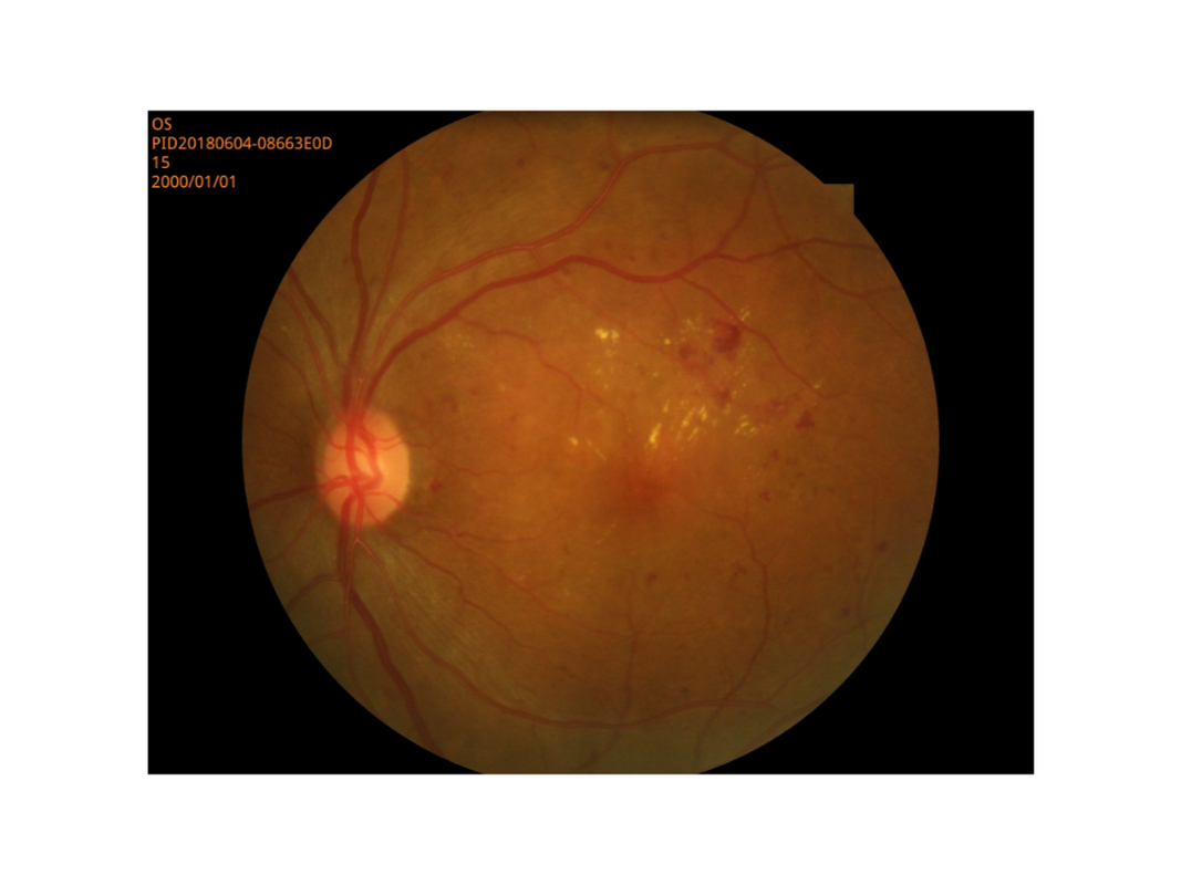 Alta resolução pequena do modo do aluno da câmera retina do fundo de Digitas da imagem latente